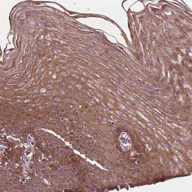 B3GALNT2 Antibody in Immunohistochemistry (IHC)