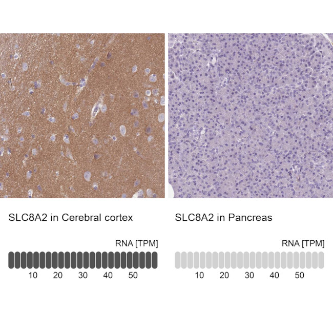 SLC8A2 Antibody in Immunohistochemistry (IHC)