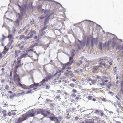 SLC8A2 Antibody in Immunohistochemistry (IHC)