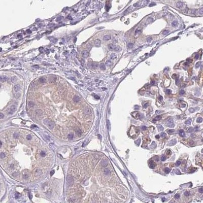 SLC8A2 Antibody in Immunohistochemistry (IHC)