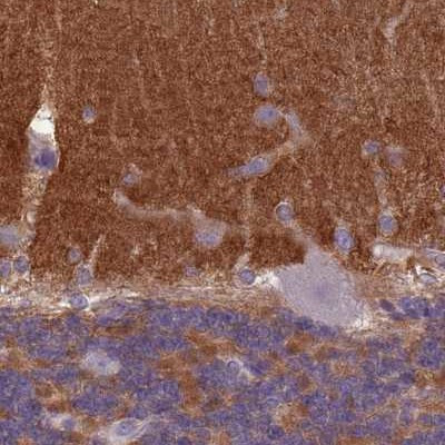 SLC8A2 Antibody in Immunohistochemistry (IHC)