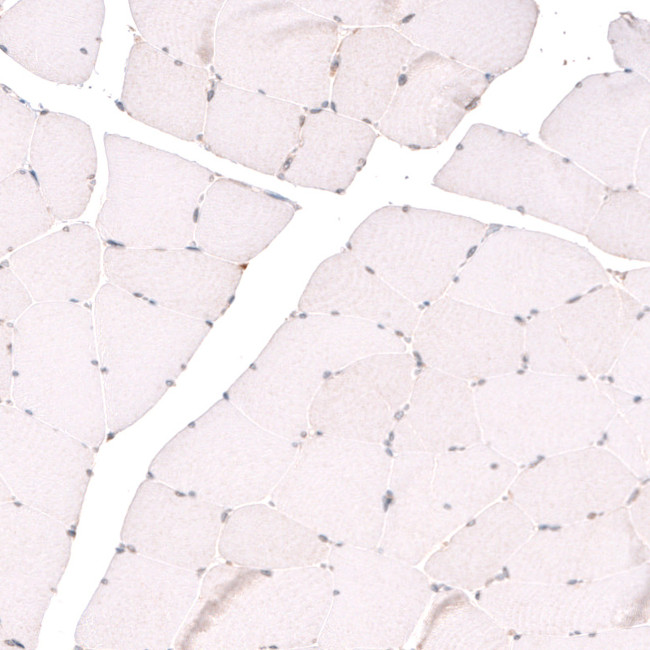 TET3 Antibody in Immunohistochemistry (IHC)