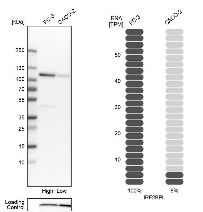 C14orf4 Antibody in Western Blot (WB)