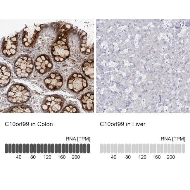 C10orf99 Antibody in Immunohistochemistry (IHC)