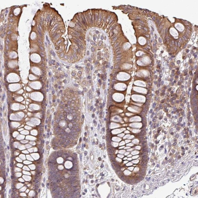 VENTX Antibody in Immunohistochemistry (IHC)