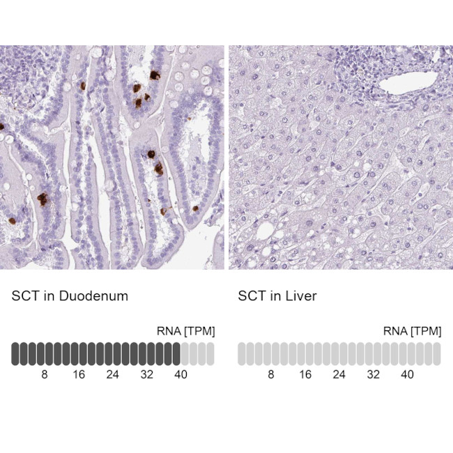 Secretin Antibody in Immunohistochemistry (IHC)