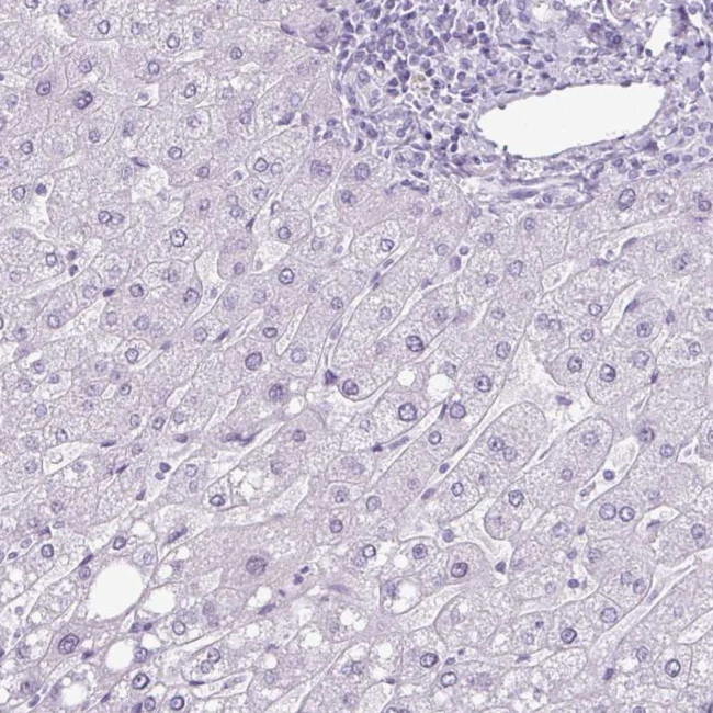 Secretin Antibody in Immunohistochemistry (IHC)