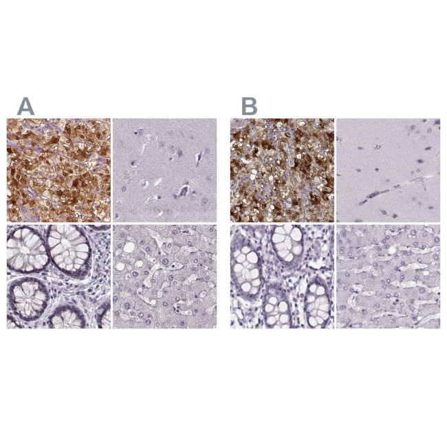 PNMT Antibody in Immunohistochemistry (IHC)