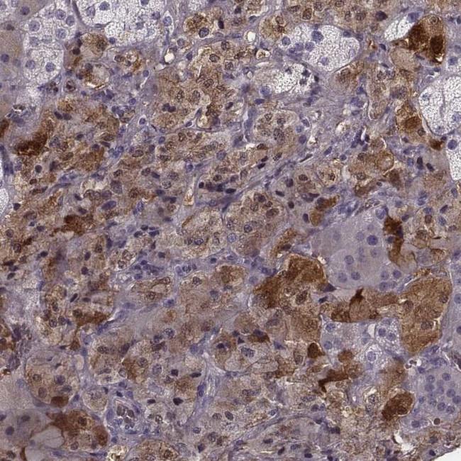 PNMT Antibody in Immunohistochemistry (IHC)