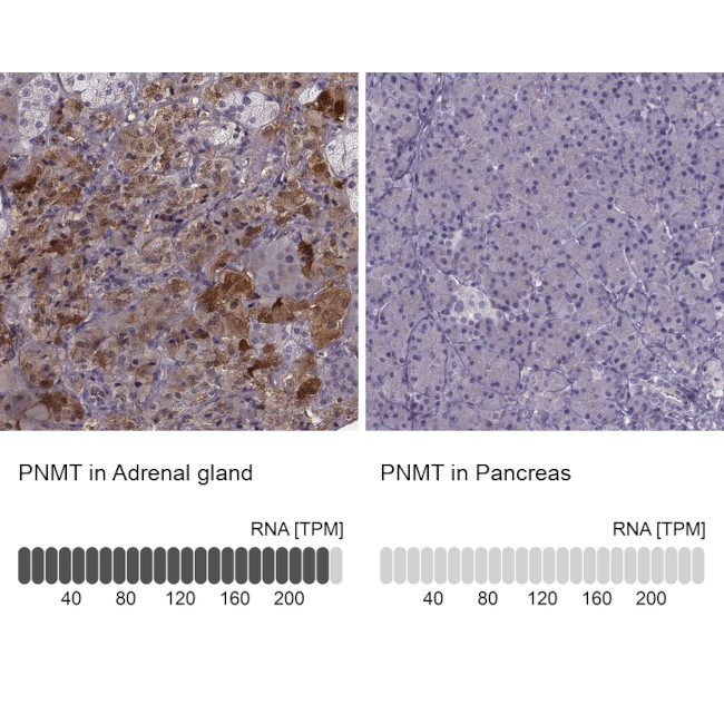 PNMT Antibody