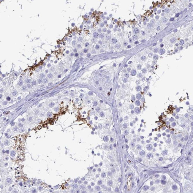 ACSBG2 Antibody in Immunohistochemistry (IHC)