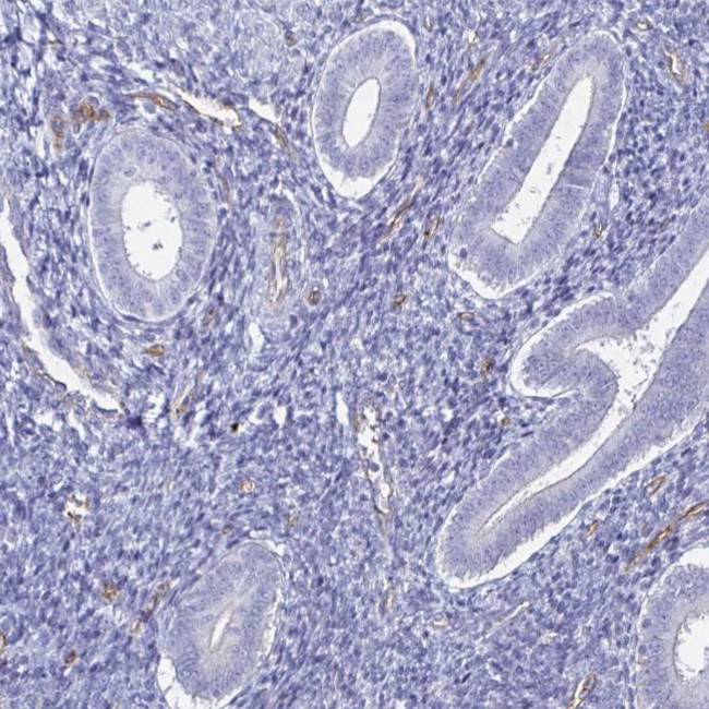 ACSBG2 Antibody in Immunohistochemistry (IHC)