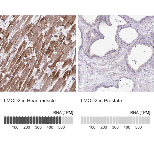 LMOD2 Antibody in Immunohistochemistry (IHC)