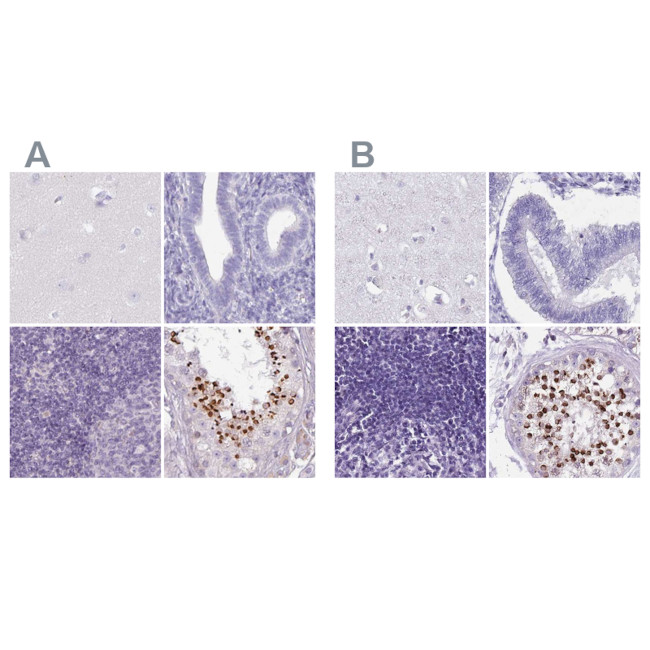 SPESP1 Antibody in Immunohistochemistry (IHC)