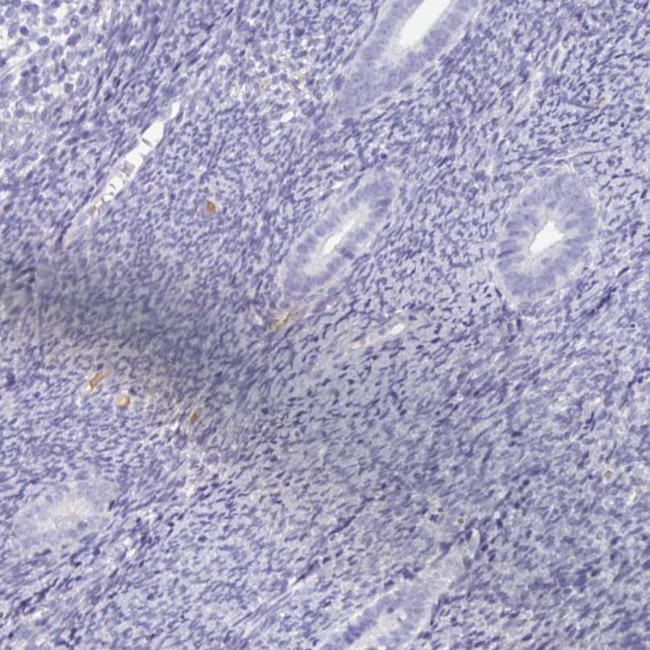 SPESP1 Antibody in Immunohistochemistry (IHC)