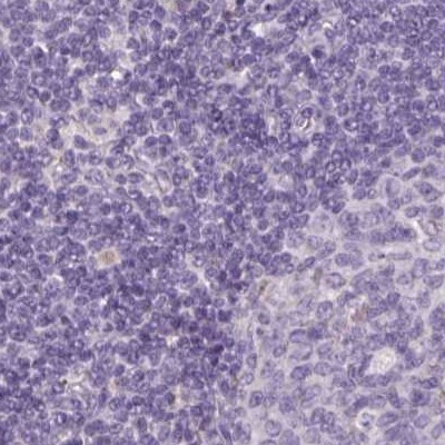 SPESP1 Antibody in Immunohistochemistry (IHC)