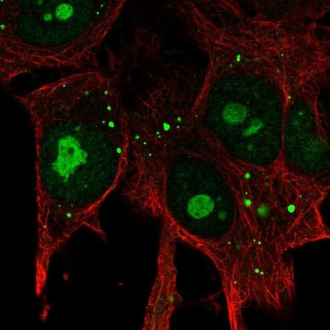 KIAA1755 Antibody in Immunocytochemistry (ICC/IF)