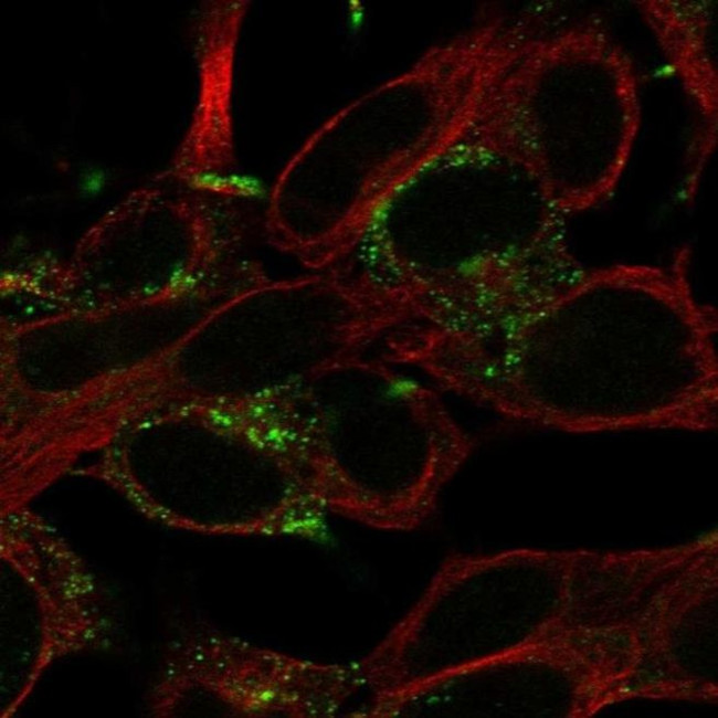 KCNT2 Antibody in Immunocytochemistry (ICC/IF)