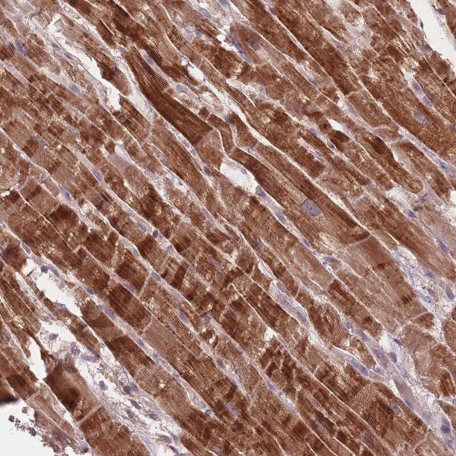 FNDC5 Antibody in Immunohistochemistry (IHC)