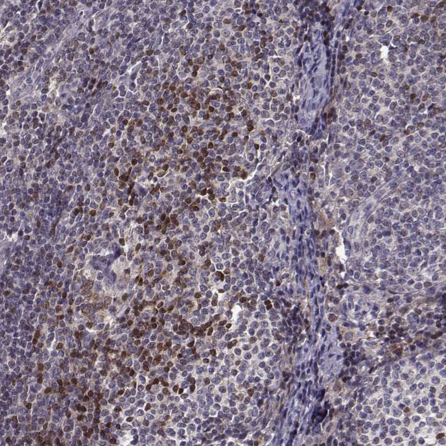 BACH2 Antibody in Immunohistochemistry (IHC)