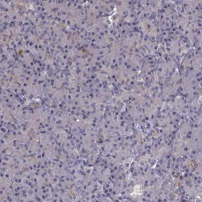 BACH2 Antibody in Immunohistochemistry (IHC)