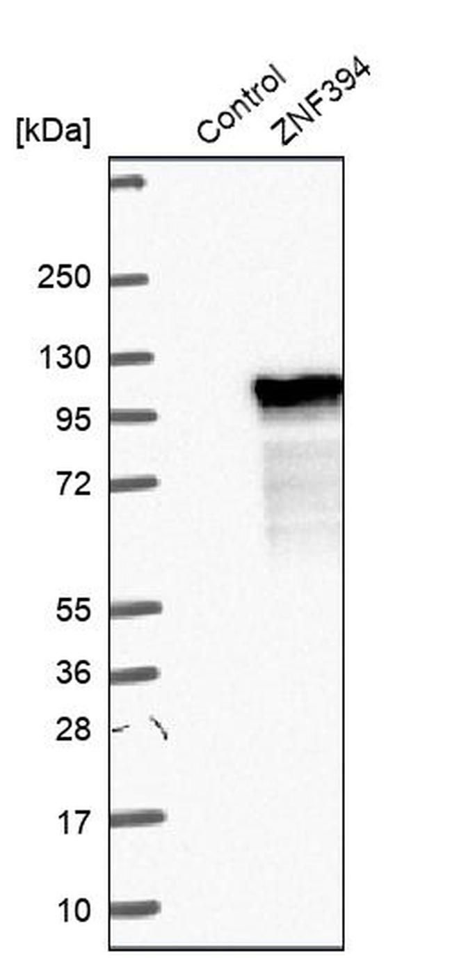 ZNF394 Antibody in Western Blot (WB)