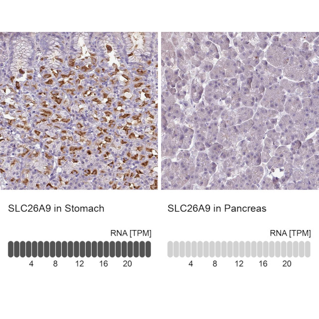 SLC26A9 Antibody in Immunohistochemistry (IHC)