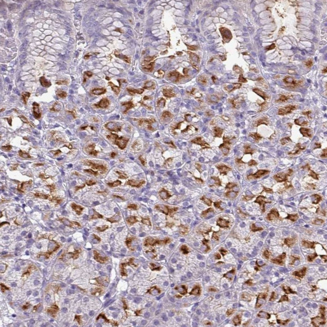 SLC26A9 Antibody in Immunohistochemistry (IHC)