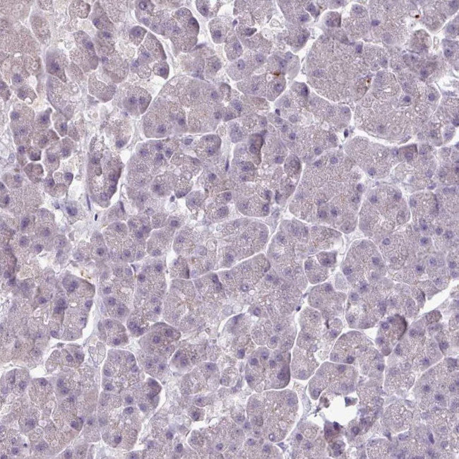 SLC26A9 Antibody in Immunohistochemistry (IHC)
