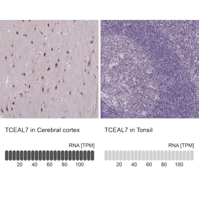 TCEAL7 Antibody in Immunohistochemistry (IHC)