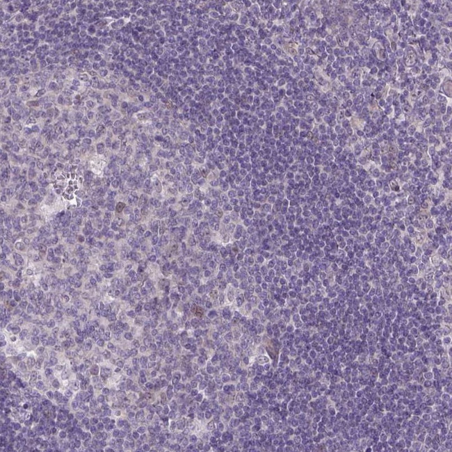 TCEAL7 Antibody in Immunohistochemistry (IHC)