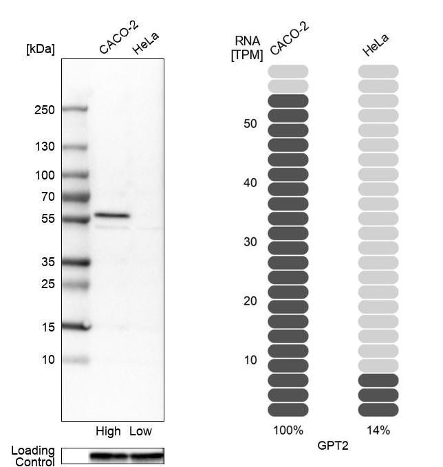 GPT2 Antibody