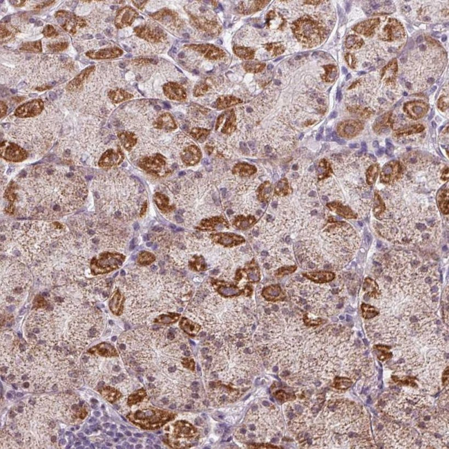 GPT2 Antibody in Immunohistochemistry (IHC)