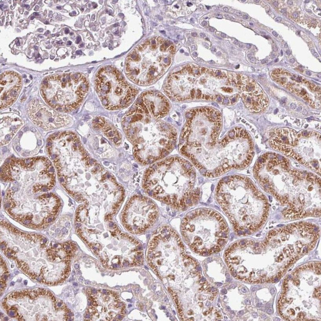 GPT2 Antibody in Immunohistochemistry (IHC)