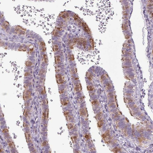 GPT2 Antibody in Immunohistochemistry (IHC)