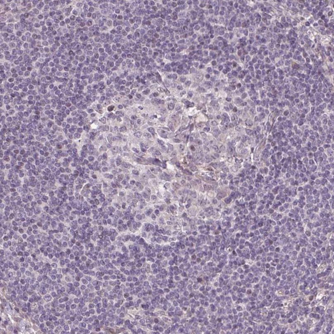 GPT2 Antibody in Immunohistochemistry (IHC)