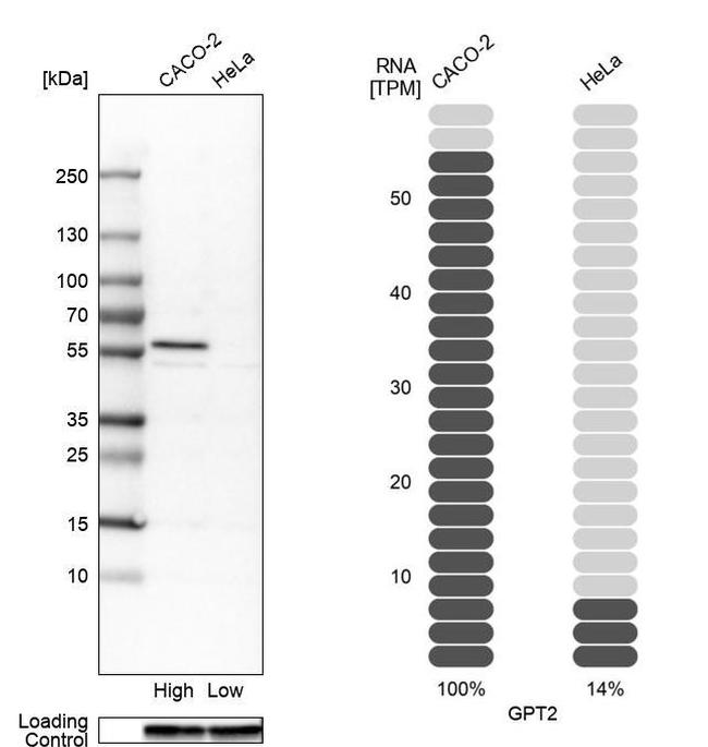 GPT2 Antibody in Western Blot (WB)