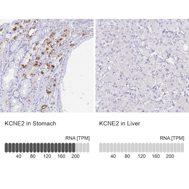 KCNE2 Antibody in Immunohistochemistry (IHC)