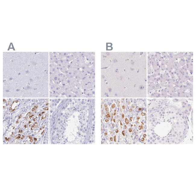 KCNE2 Antibody in Immunohistochemistry (IHC)