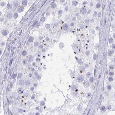 KCNE2 Antibody in Immunohistochemistry (IHC)