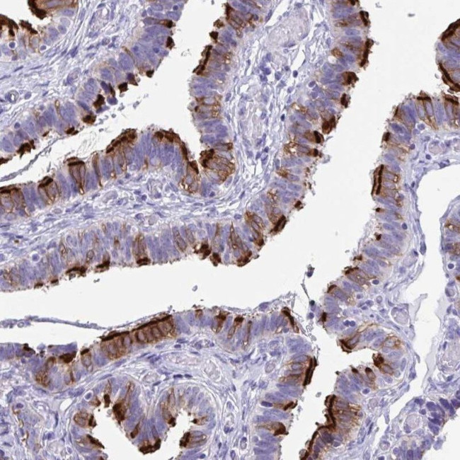 TTC30A Antibody in Immunohistochemistry (IHC)