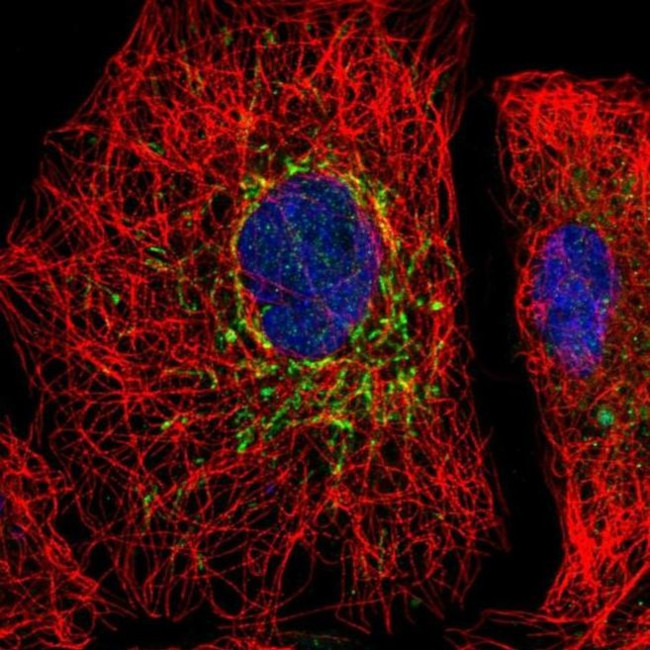 SLC25A35 Antibody in Immunocytochemistry (ICC/IF)