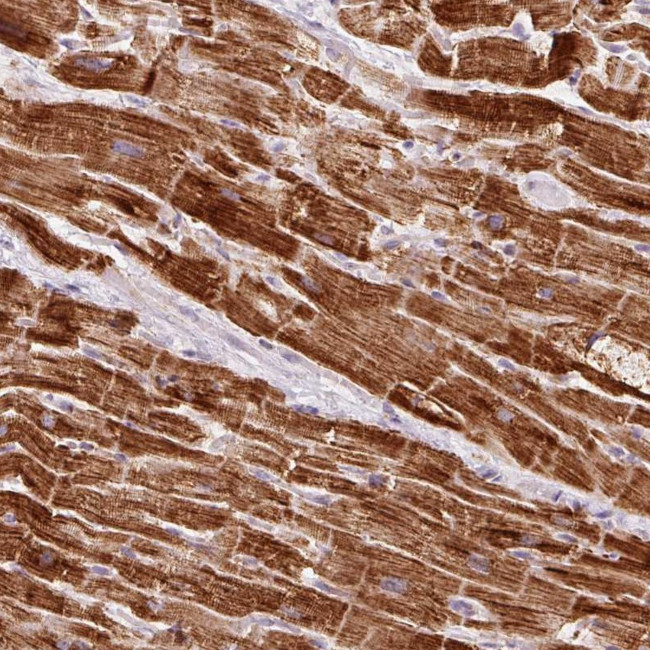 NDUFB4 Antibody in Immunohistochemistry (IHC)