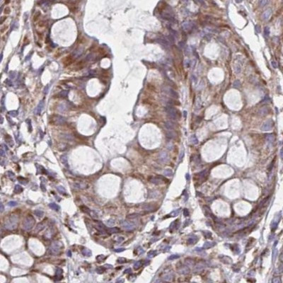 NFS1 Antibody in Immunohistochemistry (IHC)