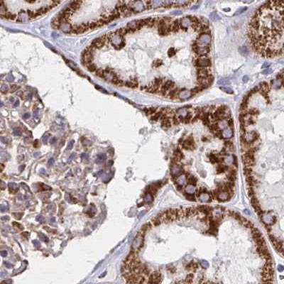 NFS1 Antibody in Immunohistochemistry (IHC)