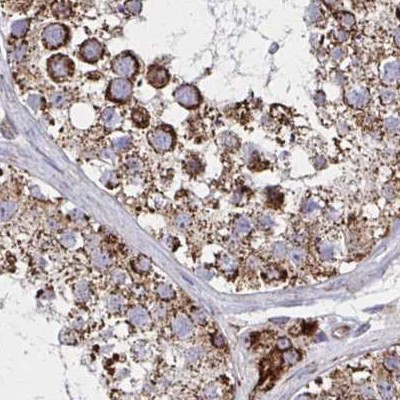 NFS1 Antibody in Immunohistochemistry (IHC)