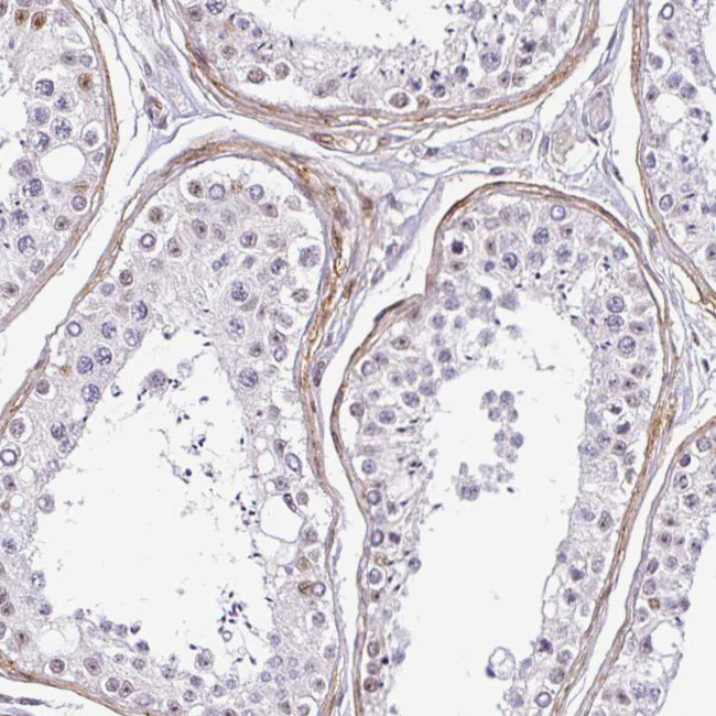 TMEM119 Antibody in Immunohistochemistry (IHC)