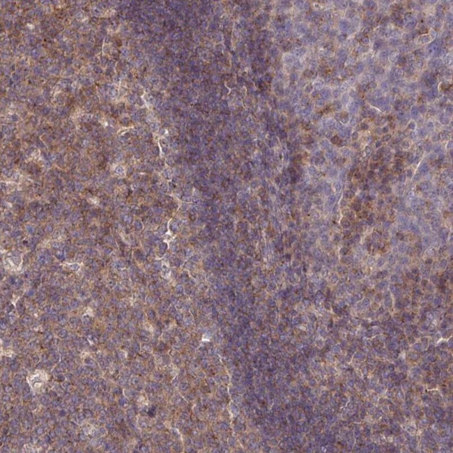 Ly-108 Antibody in Immunohistochemistry (IHC)