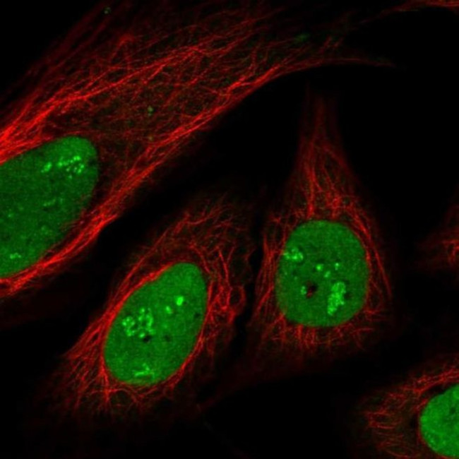 SAMD14 Antibody in Immunocytochemistry (ICC/IF)