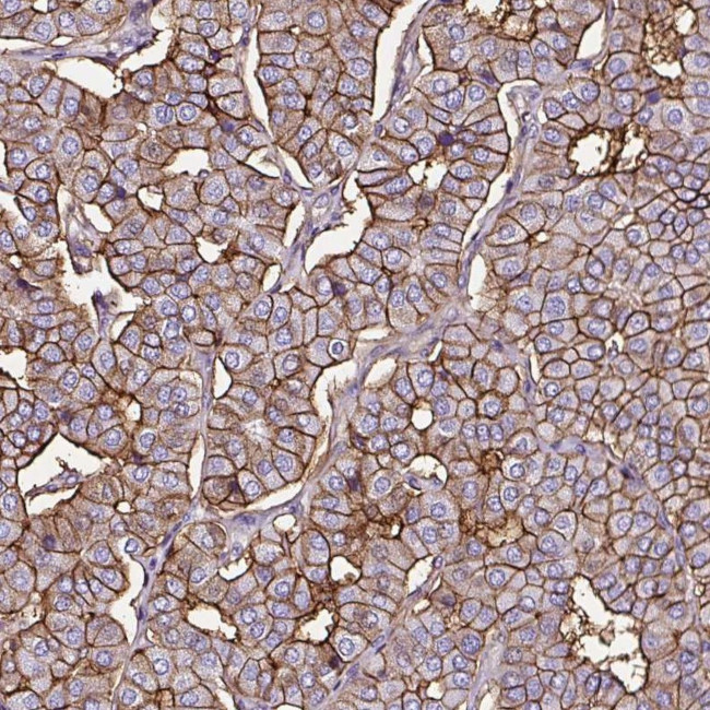 SLC7A8 Antibody in Immunohistochemistry (IHC)